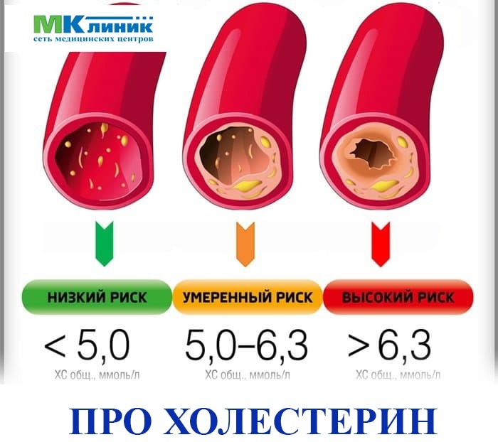 Повышенный холестерин, как снизить?